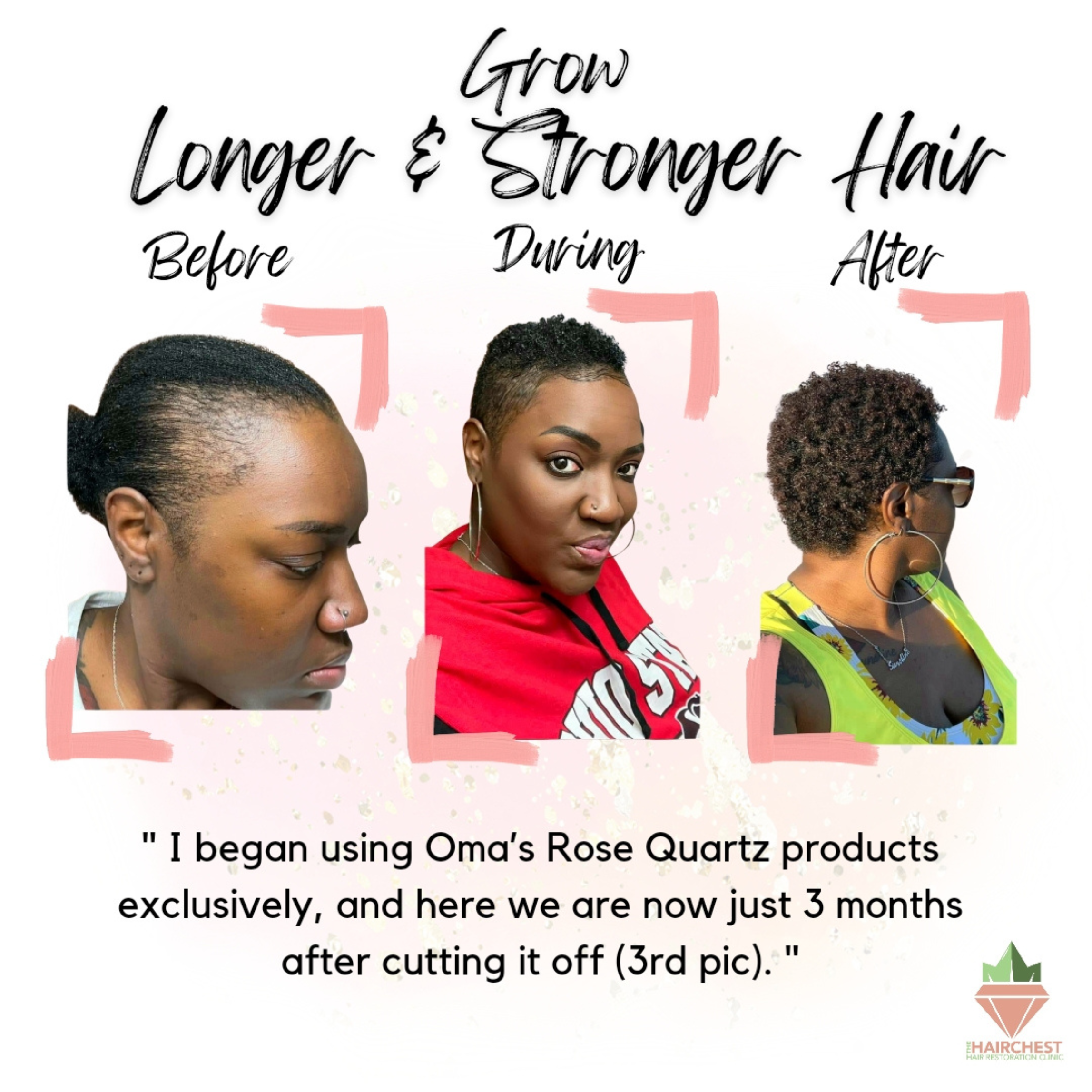 Unmatched Holistic Hair Restoration | The Hair Chest Hair